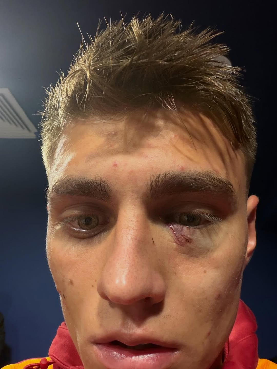 Yüzündeki yara, alnımızın akıdır!