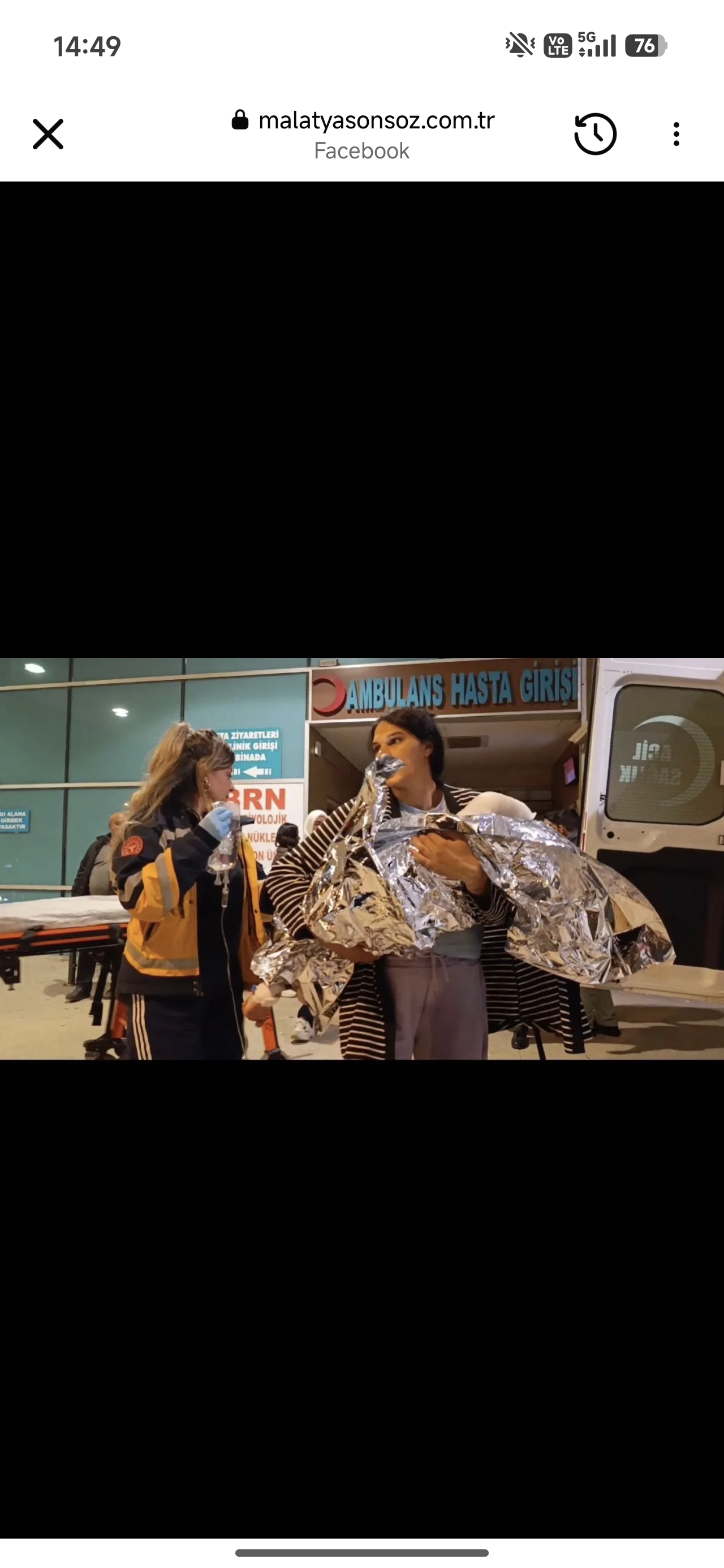 İki Yaşındaki Çocuk Dengesini Kaybederek Kaynar Suya Düştü - 2